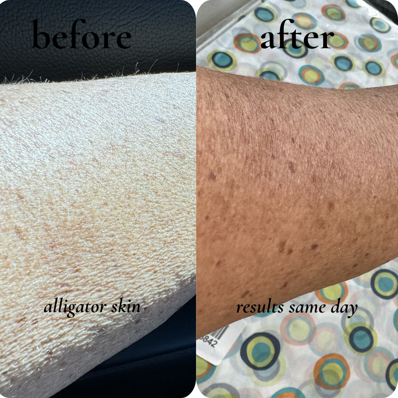 before and after