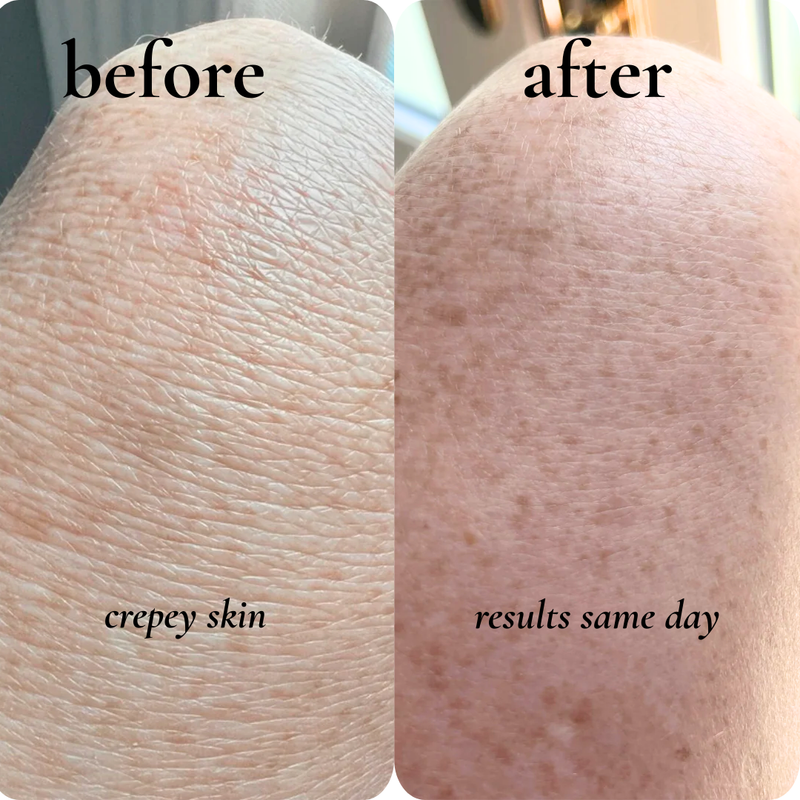 before and after