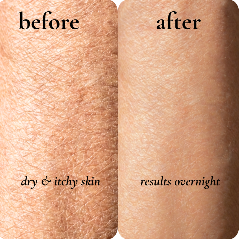 before and after