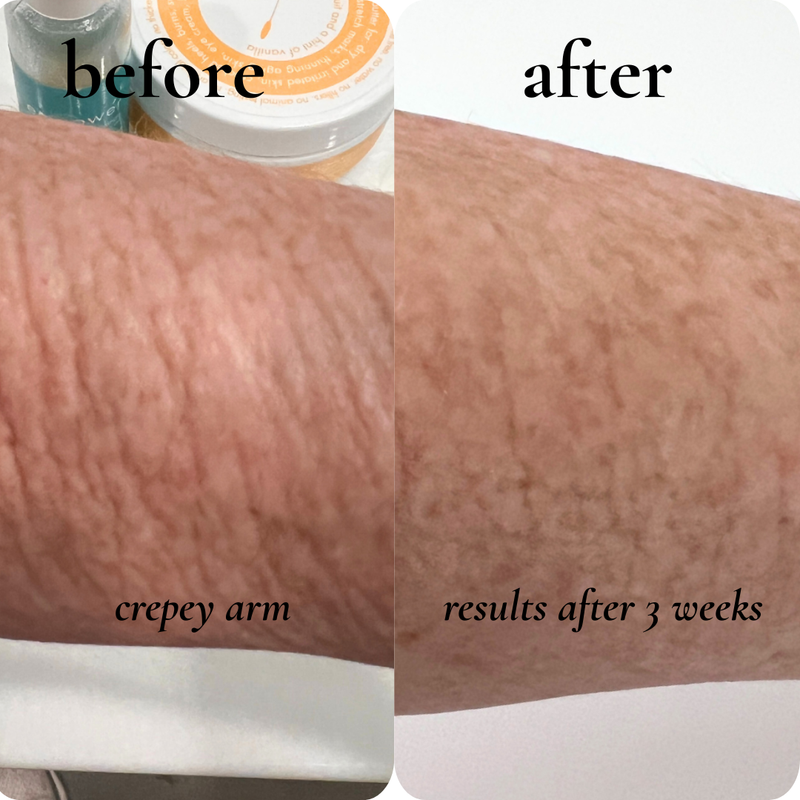 before and after