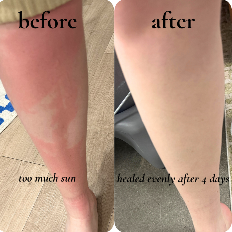 before and after