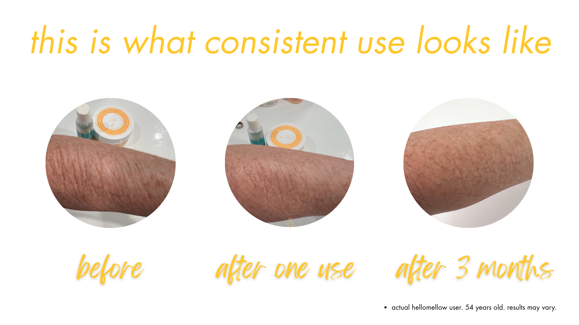 a woman's crepey skin improvement after using hellomellow
