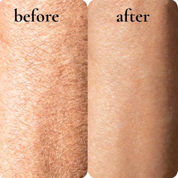 dry + aging skin
