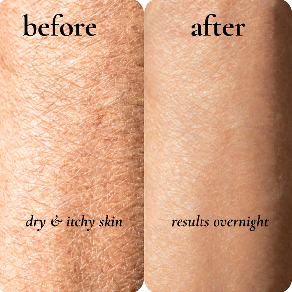 dry itchy skin
