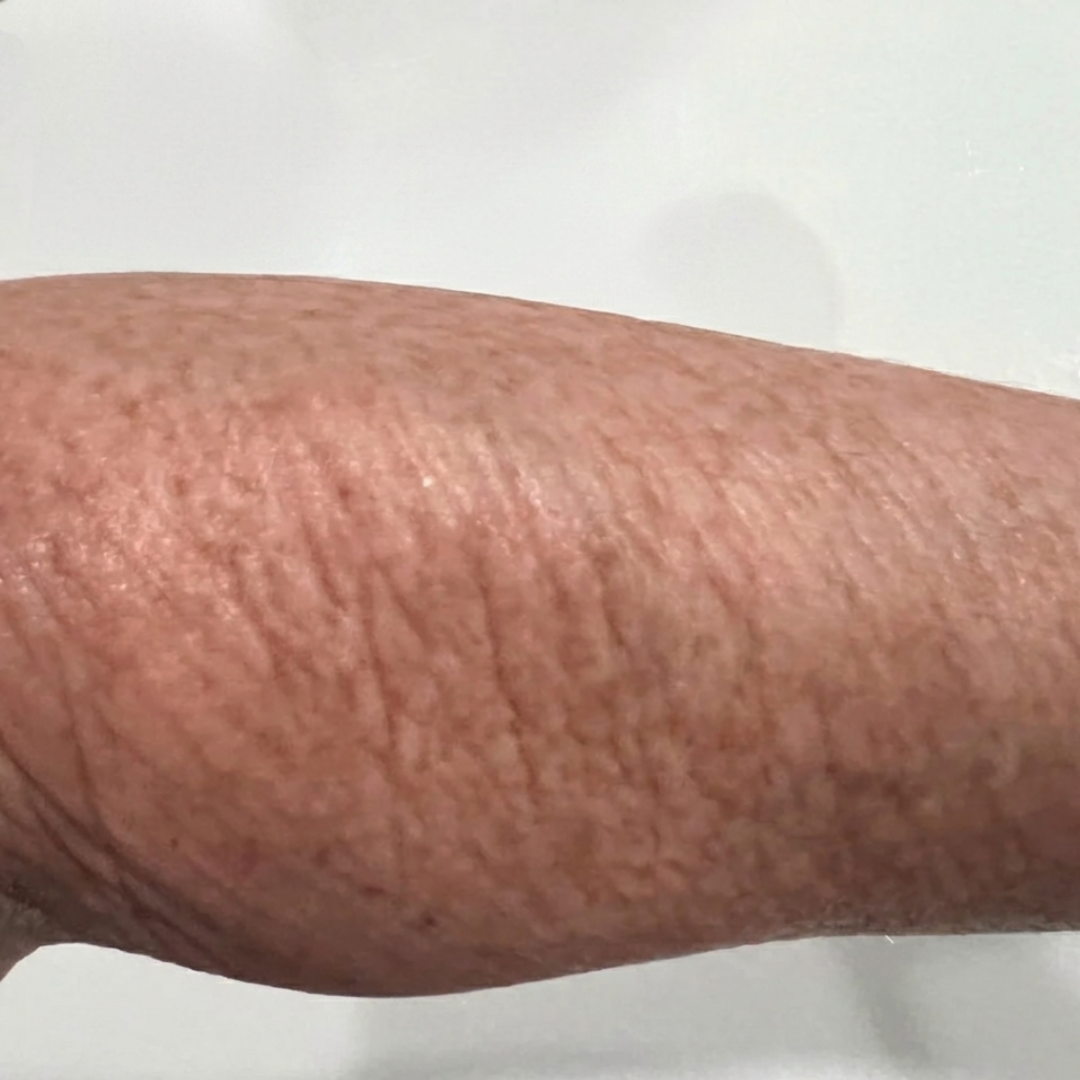 55 year old customers arm skin after using essential routine for 30 days