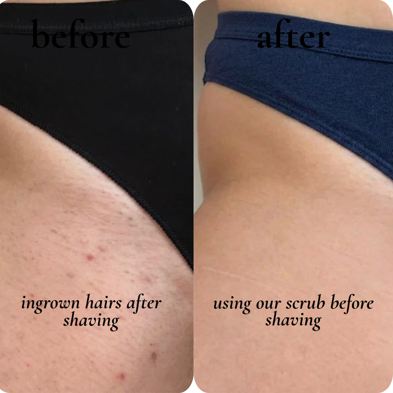 before and after