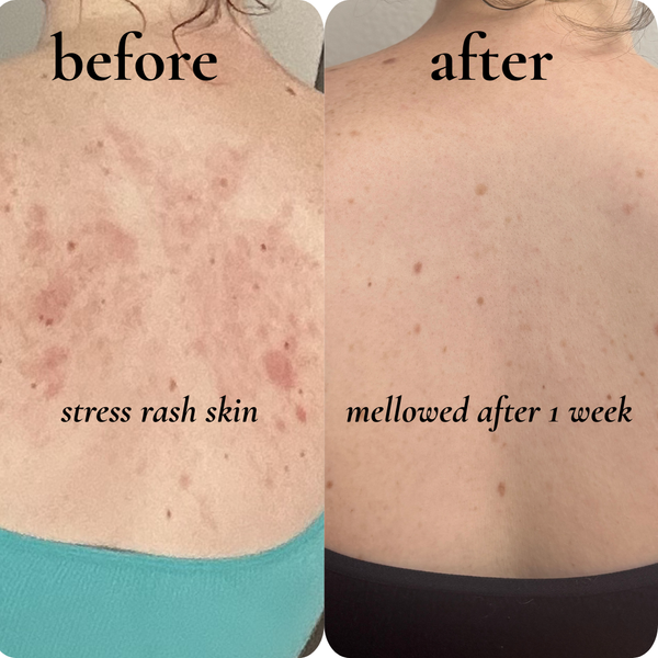 stress rash